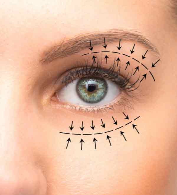 Blepharoplasty in Nagpur