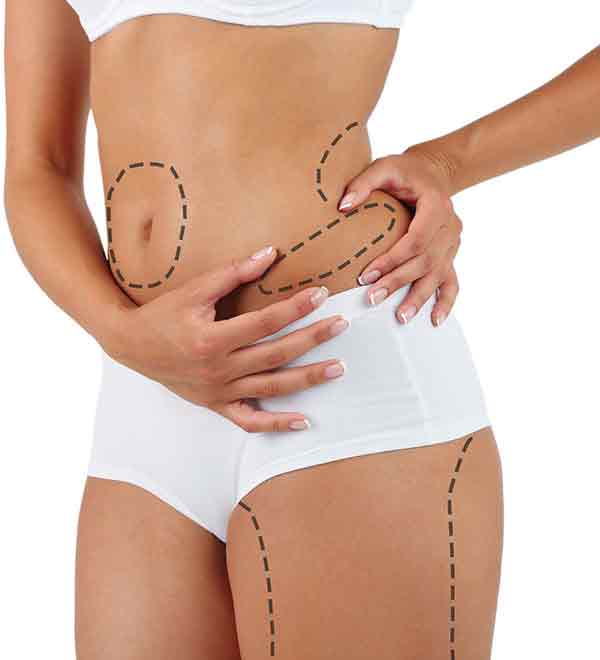 liposuction in Nagpur