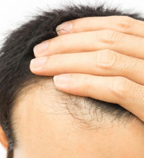 hair transplant in Nagpur